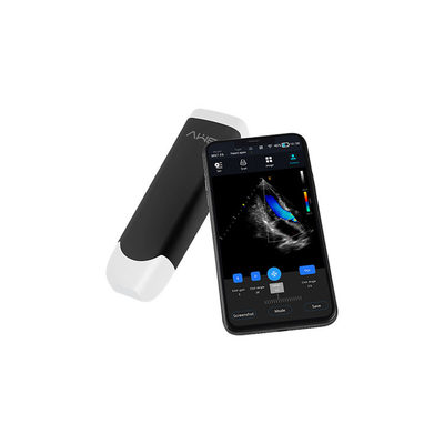 Tipo sem fio Handheld portátil varredor 2mhz da ponta de prova do ultrassom