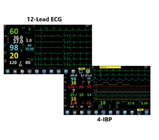 Analisador anestésico portátil TFT 15,6” LCD do oxigênio do equipamento de monitoração