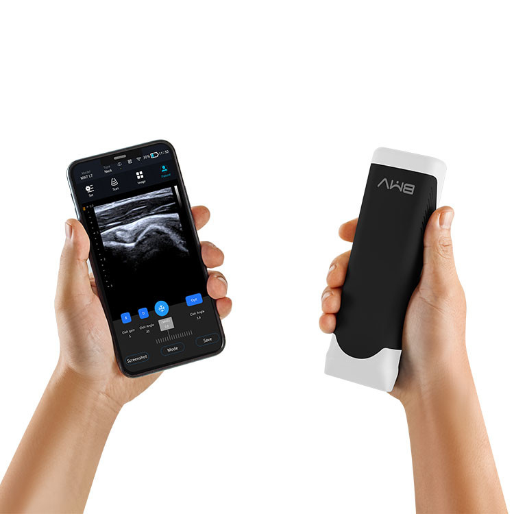 Tipo sem fio Handheld portátil varredor 2mhz da ponta de prova do ultrassom